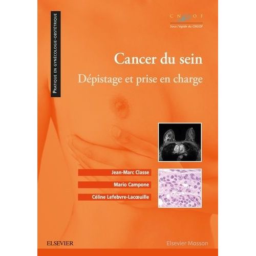 Cancer Du Sein - Dpistage Et Prise En Charge   de Collectif  Format Beau livre 