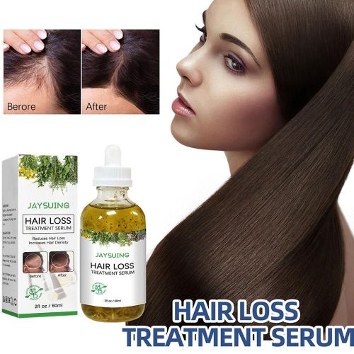 Chteau De Soin Des Cheveux Pour La Croissance Des Cheveux, Huile Pour La Perte De Cheveux, Hydratation Et Nutrition, Essence De Cheveux Pour Femmes, Cheveux Secs Et Abms Wiltshire, Cheveux Boucls,