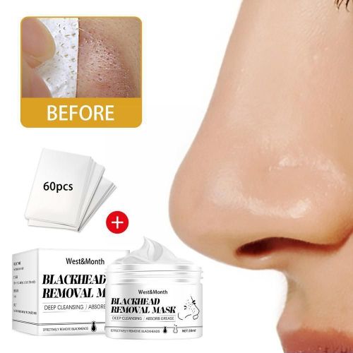 Dissolvant De Points Noirs Pour Le Nez, 30g, Rtrcissement Des Pores Du Visage, Nettoyage En Profondeur De La Peau, Peeling, Acn, Soin Des Points, R2d1