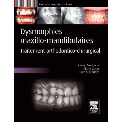 Dysmorphies Maxillo-Mandibulaires - Traitement Orthodontico-Chirurgical   de Canal Pierre  Format Reli 