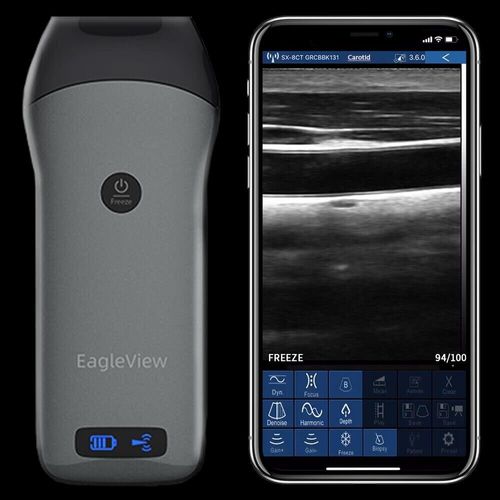 Eagleview- Scanner  Ultrasons De Type Sonde Sans Fil Linaire Dopler Echographie
