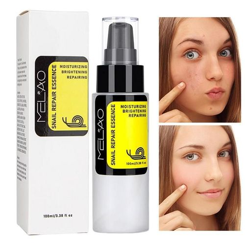 Essence Hydratante  La Bave D'escargot Pour Le Visage, claircissante Pour Les Ridules, Dissolvant De Taches Dformables, Anti-ge, Boisson Pour Les Pores, 100ml