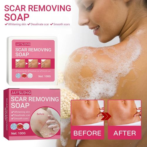 tiquettes De Savon  L'huile De Rose Noire M7z0, Dissolvant De Verrues, Traitement Des Boutons, Essence, Amliore Le Nettoyage, claircit Les Taches De Rousseur En Profondeur