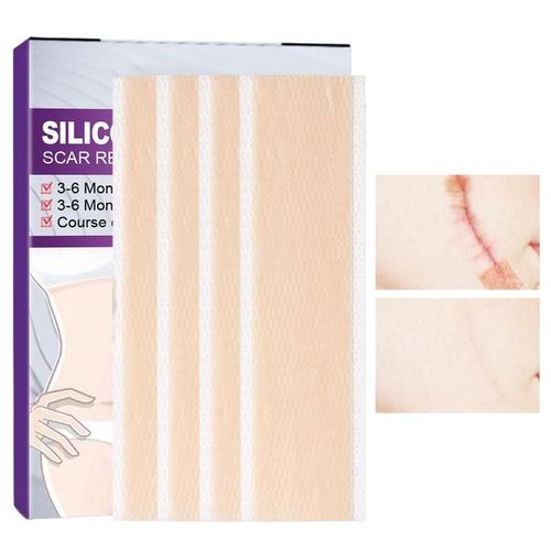 Feuilles De Rparation De Cicatrices En Silicone Indolore, Bandes D'limination Efficaces Des Cicatrices Pour La Section C, La Brlure Chlode, L'acn, Le Patch, 4 Pices