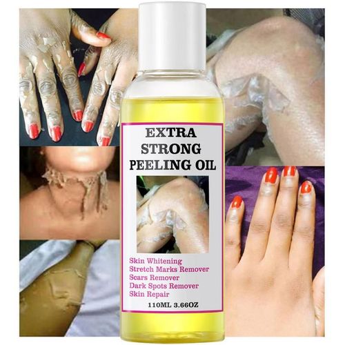 Huile De Peeling Jaune, Dissolvant De Taches Fonces Et De Vergetures, Srum Hydratant Blanchissant, Efface Les Cellules Mortes De La Peau, Essence