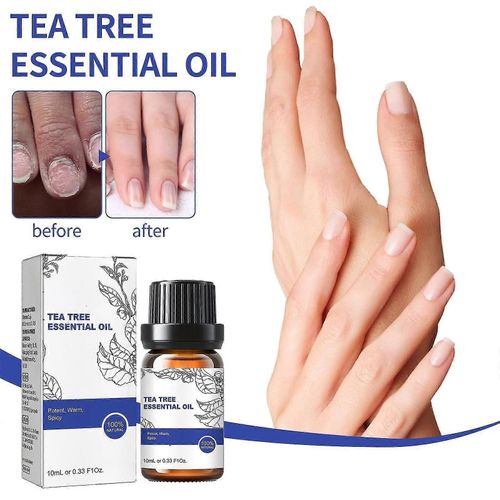 Huile Essentielle D'arbre  Th, Traitement Des Champignons Des Ongles D'orteils, Huile Essentielle D'arbre  Th De Croissance Des Cheveux, Ajouter Au Shampooing Gel Douche Revitalisant Natures Solution