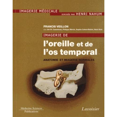Imagerie De L'oreille Et De L'os Temporal - Tome 1, Anatomie Et Imagerie Normales   de Veillon Francis  Format Broch 
