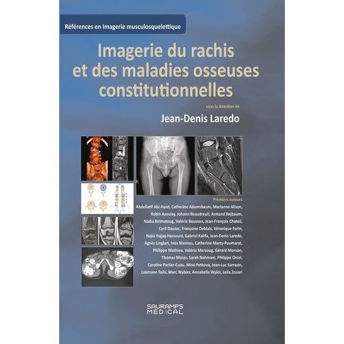 Imagerie Du Rachis Et Des Maladies Osseuses Constitutionnelles - Rachis De L'adulte Et Maladies Osseuses De L'enfant Vues  L'ge Adulte   de Collectif  Format Beau livre 