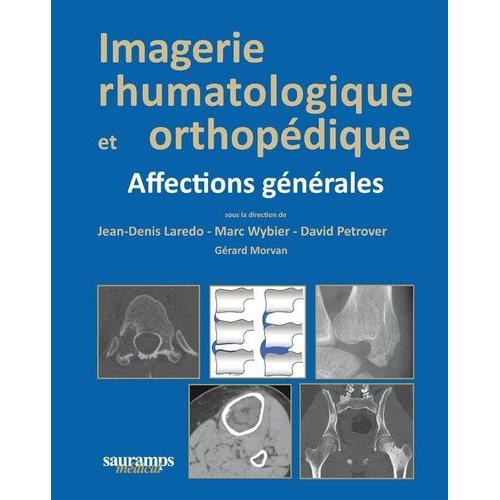 Imagerie Rhumatologique Et Orthopdique - Tome 1, Affections Gnrales   de Laredo Jean-Denis  Format Reli 