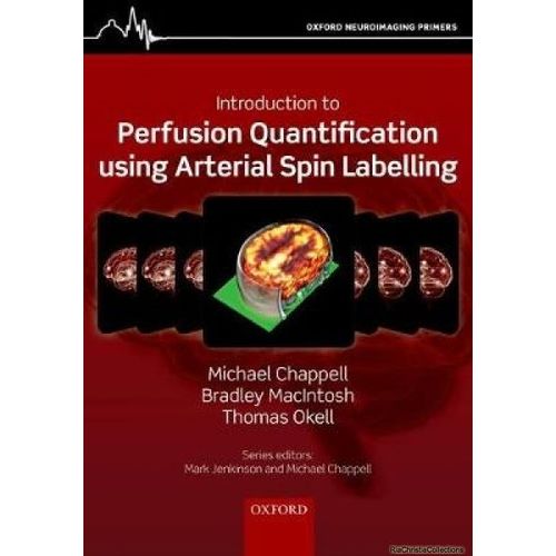 Introduction To Perfusion Quantification Using Arterial Spin Labelling    Format Broch 