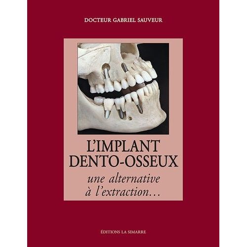 L'implant Dento-Osseux - Une Alternative  L'extraction    Format Grand Format 