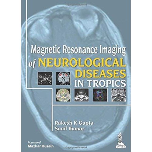 Magnetic Resonance Imaging Of Neurological Diseases In Tropics   de Rakesh K. Gupta  Format Reli 