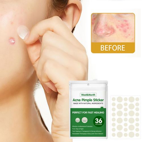 Patchs Autocollants Pour Boutons D'acn, 36 Pices, Patch Impermable, Dissolvant D'acn, Peau, Boutons Invisibles, Soins, Traitement Respirant, U8h3