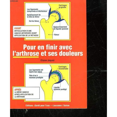 Pour En Finir Avec L'arthrose Et Ses Douleurs   de JAQUES ELIANE  Format Broch 