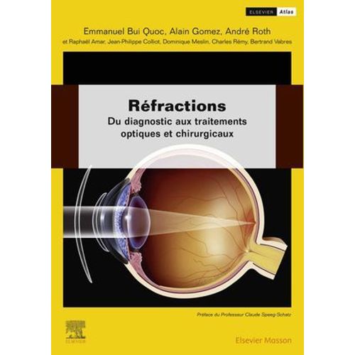 Rfractions  