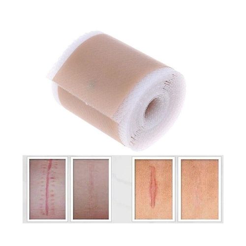 Ruban Adhsif En Gel De Silicone Pour Le Traitement Des Cicatrices  4 Cm X 150 Cm, Rutilisable Et Lavable Pour Un Traitement Efficace Des Cicatrices