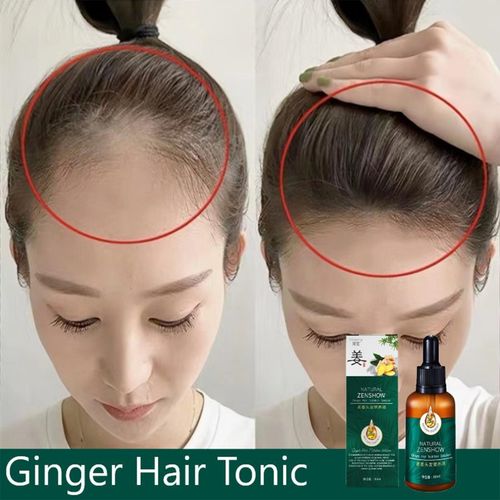 Srum De Croissance Capillaire Rapide En Spray, Liquide De Traitement Du Cuir Chevelu, Soins Pour Prvenir La Perte De Cheveux, Huile De Traitement Du Cuir Chevelu Pour Hommes Wom V8a2