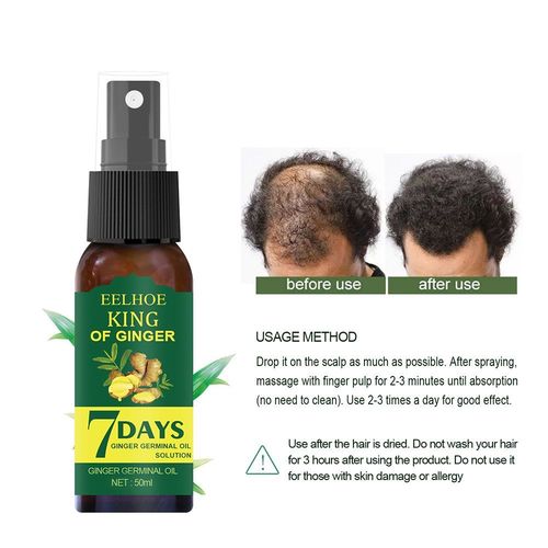 Srum Pour La Croissance Des Cheveux Abms, Soin  L'huile De Barbe, Spray Pour Cheveux Abms, Essence De Gingembre, Croissance Rapide