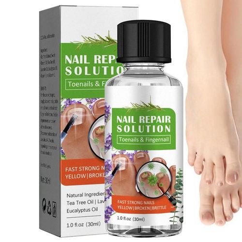 Solution De Champignons Pour Ongles pais, Solution Pour Ongles pais Et Forts, Arbre  Th Et Mlange D'huiles Essentielles Pour Restaurer