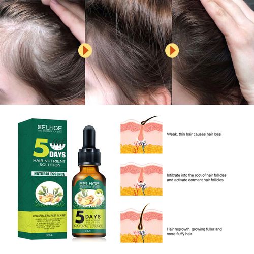 Solution Nutritive Aux Huiles Essentielles Pour Cheveux, Soin Contre La Perte De Cheveux, Rend Les Cheveux Plus Lisses, Dlivre Des Cheveux Denses, Croissance Rapide, 30ml, 5 Jours