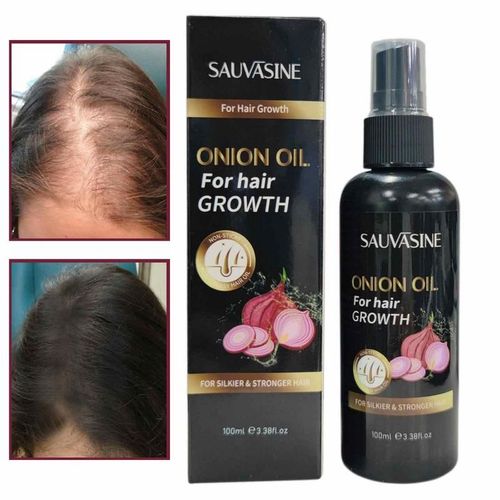 Spray D'huile Capillaire  Base D'oignon Noir, 3.38oz, Pour Un Soin Naturel Et Une Croissance Des Cheveux, Pour Prvenir La Perte De Cheveux, Croissance Rapide, Hydratant