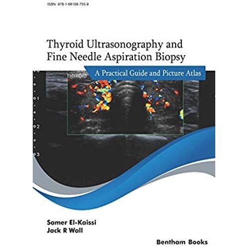 Thyroid Ultrasonography And Fine Needle Aspiration Biopsy    Format Broch 