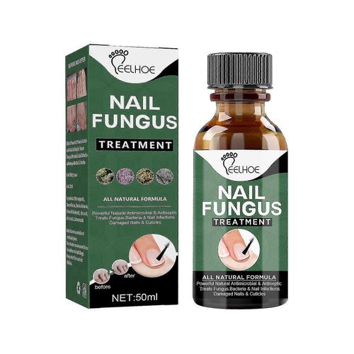 Traitement Des Champignons Des Ongles, Traitement Des Champignons Des Ongles Des Orteils De 50 Ml, Solution De Rparation Des Ongles Extra Forte Avec Extrait Naturel DHuile DArbre  Th