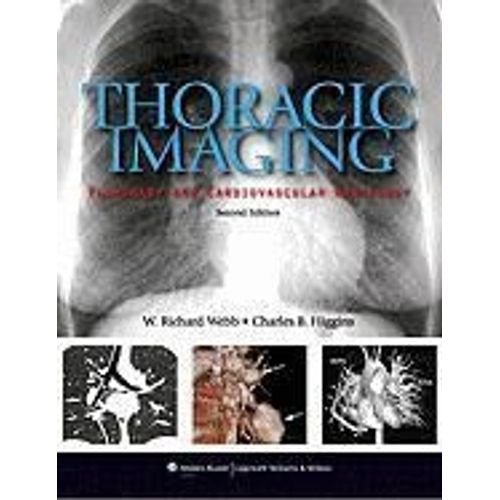 Thoracic Imaging: Pulmonary And Cardiovascular Radiology [With Free Web Access]   de W. Richard Webb 