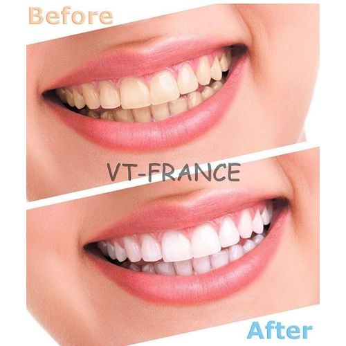 Gel Blanchiment Dents Peroxyde 44% Blanc