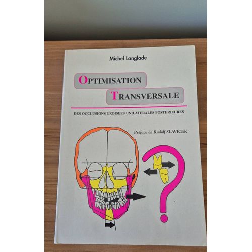 Optimisation Transversale Des Occlusions Croisées Unilatérales Postérieures