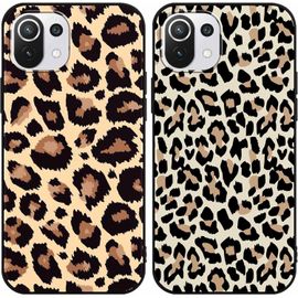 KAL-2 Pièces Coque Pour Xiaomi Mi 11 Lite 4G/5G/5G Ne 6,55"" Motif De Lmprimé Léopard Étui, Aesthetic Design Housse De Téléphone Silicone Antichoc Protection Case Cover Pour Xiaomi Mi 11 Lite