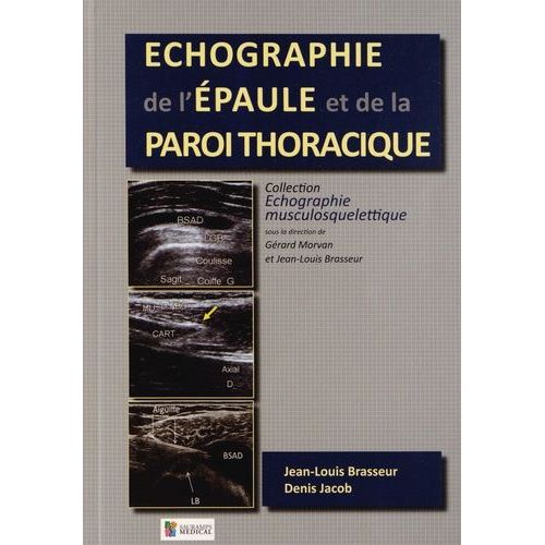 Echographie De L'épaule Et De La Paroi Thoracique