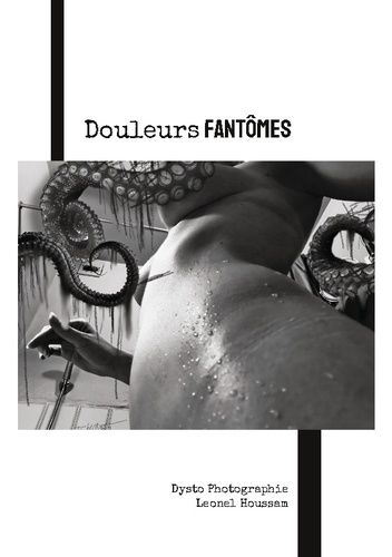Douleurs Fantômes