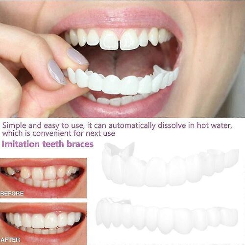 Sourire Dentaire Fausses Dents Couvrir Sourire Parfait Facettes Confort Fit Dents Dentures Flexibles 