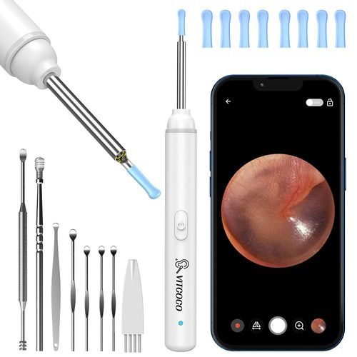 Vitcoco Otoscope Oreille Pour Enlever Le Cérumen, Otoscope Oreille 1920p Wifi, Camera Oreille Nettoyage, Cure Oreille Camera Avec 6 Led Pour Iphone, Ipad Et Smartphones Android - Blanc 