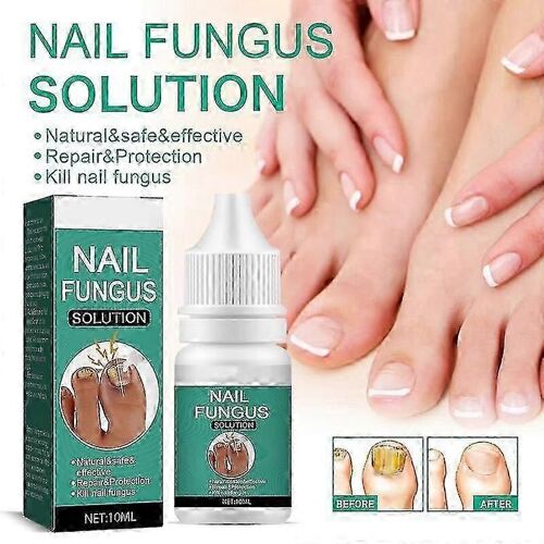 Traitement Fongique Des Ongles Pour Ongle Extra Fort,Traitement Des Ongles Incarnés Huiles De Soin Des Ongles,Toenail Fu