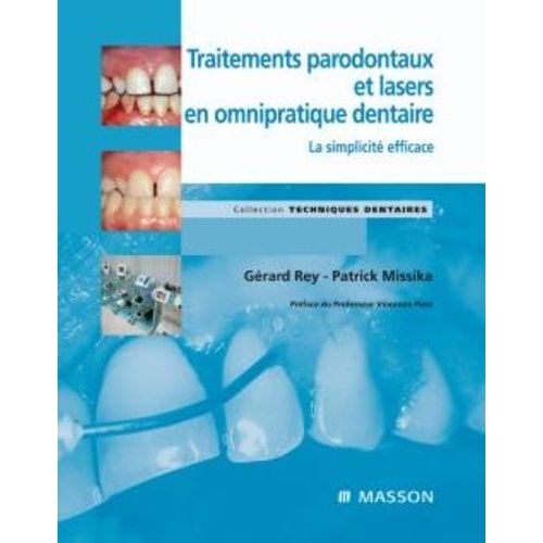 Traitements Parodontaux Et Lasers En Omnipratique Dentaire - La Simplicité Efficace