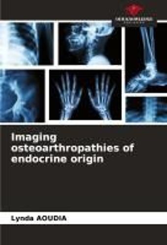Imaging Osteoarthropathies Of Endocrine Origin
