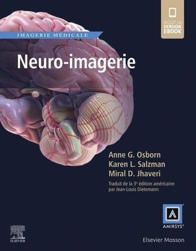 Neuro-Imagerie