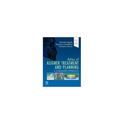 Atlas Of Aligner Treatment And Planning