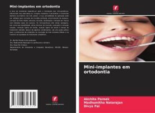 Mini-Implantes Em Ortodontia