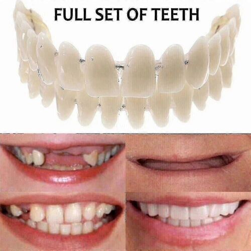 Plaquettes De Fausses Dents Supérieures Et Inférieures Réglables Par Encliquetage Pour Un Sourire Parfait