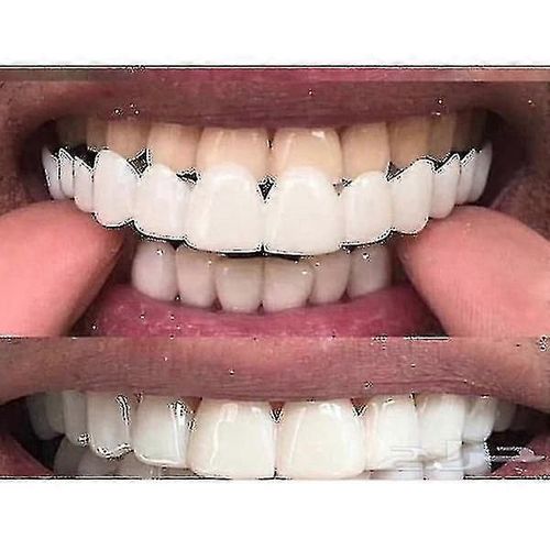 Appareil Dentaire Blanchissant Comfort Fit Flex Supérieur/Inférieur - Dents Supérieures Blanc