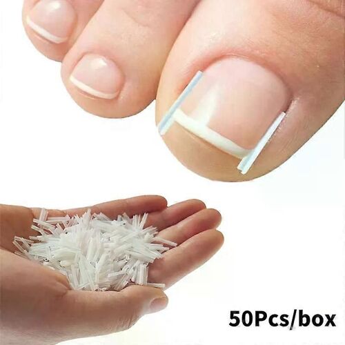 50pcs / Box Bandes De Correction D'ongle Incarné Paronychia Correction Redressement Attelle Orthèse Orteil Traitement Des Ongles Groove Outils De Pédicure