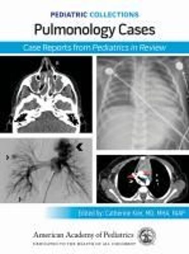 Pediatric Collections: Pulmonology Cases: Case Reports From Pediatrics In Review