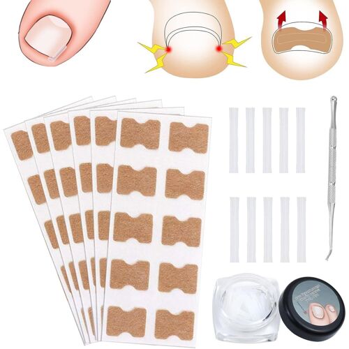 Autocollants De Correction,Ensemble D'outil Ongle Incarné,Autocollant De Correction Des Ongles,Correction Ongle Incarné,Ongles Incarnés Correcteur,Patch Correction Ongle,Pour Le Soin Des Ongles 