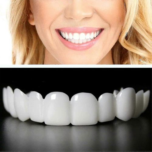 Facettes Dentaires Supérieures Et Inférieures - 2 Paires De Fausses Dents Pour Appareils Orthodontiques, Blanchiment Parfait, Taille Des Fausses Dents Blanc