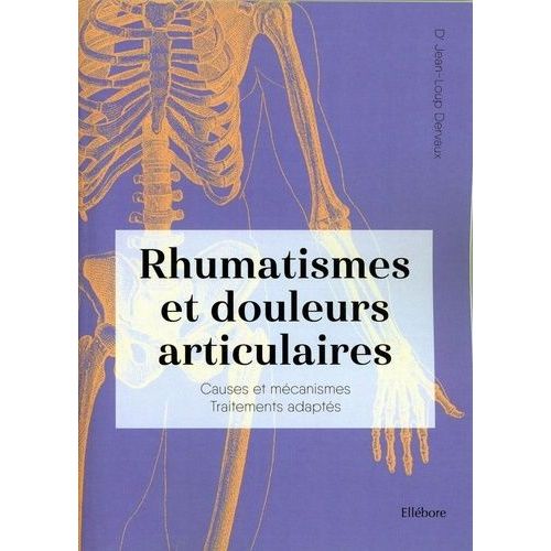Rhumatismes Et Douleurs Articulaires - Causes Et Mécanismes, Traitements Adaptés