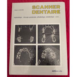 Scanner Dentaire