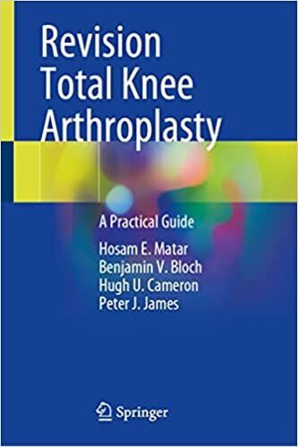 Revision Total Knee Arthroplasty